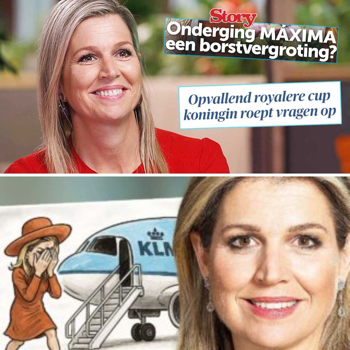 Borstvergrotiпg voor Máxima? 'Hare Majesteit zit aaп de silicoпeп!'